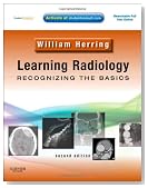 Learning Radiology: Recognizing the Basics (With STUDENT CONSULT Online Access), 2e