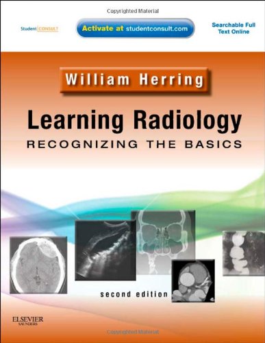 Textbook - Learning Radiology: Recognizing the Basics (With STUDENT CONSULT Online Access), 2e