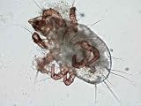 Dust Mite under Microscope - 24