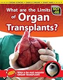 What are the limits of organ transplantation?