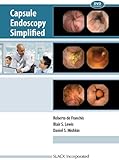 Capsule endoscopy simplified