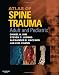 Atlas of Spine Trauma with CD-ROM: Adult & Pediatric