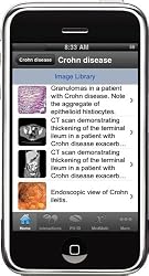 Handheld Medical Bundle: 8 GB iPod touch (3rd Generation) w/ Epocrates Essentials Software