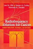 Radiofrequency Ablation for Cancer: Current Indications, Techniques and Outcomes