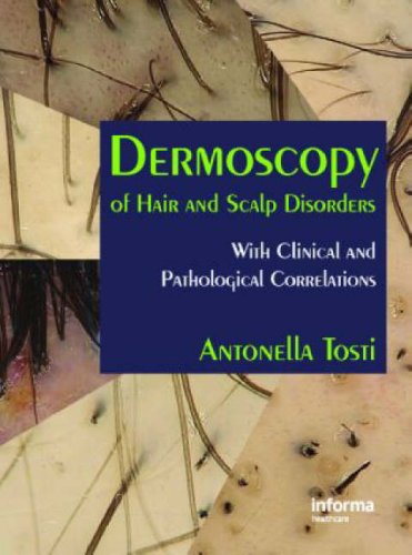 Dermoscopy of Hair and Scalp Disorders: Pathological and Clinical Dermoscopy of Hair and Scalp Disorders: Pathological and Clinical