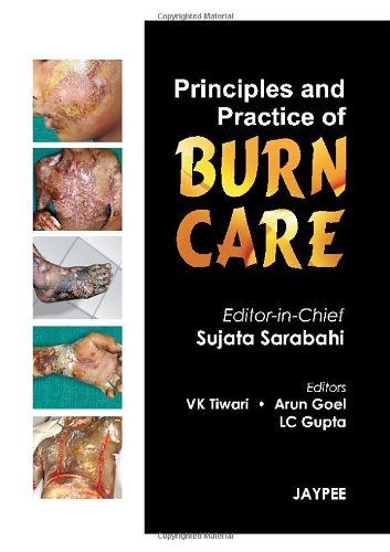 Principles and Practice of Burn Care