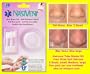 Anti Snoring and Sleep Apnea Aid. Nasivent 100% Grade Medical Soft Silicone Nose Dilator. Increase Oxygen and Lowers High Blood Pressure. Anti Snoring and Sleep Apnea Aid. Nasivent 100% Grade Medical Soft Silicone Nose Dilator. Increase Oxygen and Lowers High Blood Pressure.