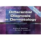 Differential Diagnosis in Dermatology by  Richard Ashton and Barbara Leppard