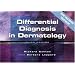 Differential Diagnosis in Dermatology