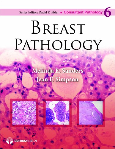 Breast Pathology (Consultant Pathology)