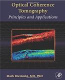 Optical Coherence Tomography: Principles and Applications