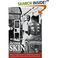 Acres of Skin: Human Experiments at Holmesburg Prison