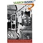 Acres of Skin: Human Experiments at Holmesburg Prison