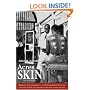 Acres of Skin: Human Experiments at Holmesburg Prison
