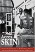 Acres of Skin: Human Experiments at Holmesburg Prison