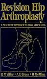 Revision hip arthroplasty : a practical approach to bone stock loss