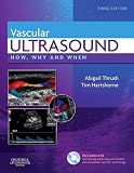 Vascular Ultrasound: How, Why and When