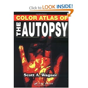 Color Atlas of the Autopsy