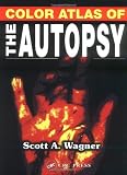 Color Atlas of the Autopsy