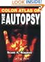 Color Atlas of the Autopsy