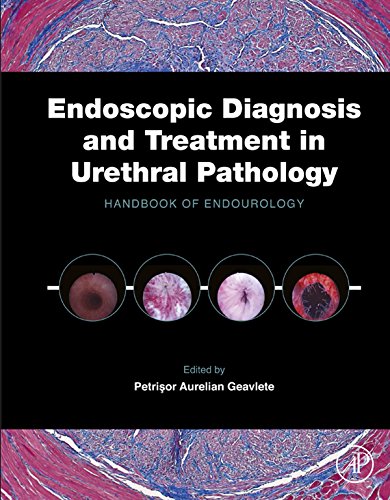 Endoscopic Diagnosis and Treatment in Urethral Pathology: Handbook of Endourology