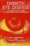 Diabetic eye disease : an illustrated guide to diagnosis and management