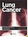 Lung Cancer