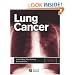 Lung Cancer