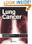 Lung Cancer