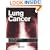 Lung Cancer