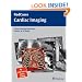 Cardiac Imaging (RadCases)