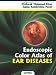 Endoscopic Color Atlas of Ear Diseases at Amazon Books: 51tyF8p42BL._SL75_