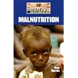 Malnutrition (Diseases and Disorders)