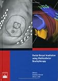 Partial Breast Irradiation Using Multicatheter Brachytherapy