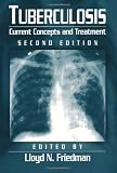 Tuberculosis: Current Concepts and Treatment, Second Edition