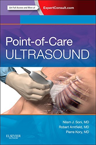 By Nilam J Soni MD Point of Care Ultrasound, 1e (1 Pap/Psc) [Paperback]