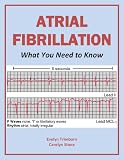 Atrial Fibrillation: What You Need to Know (Health Matters)