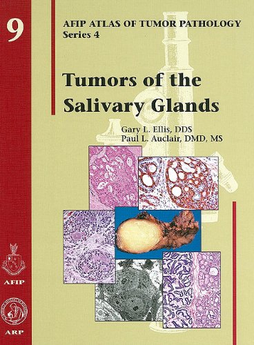 Tumors of the Salivary Glands (AFIP Atlas of Tumor Pathology: Series 4)