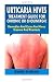 Urticaria Hives : Treatment Guide For Chronic Or Cholinergic: Remedies And Cures For Hives, Eczema And Psoriasis