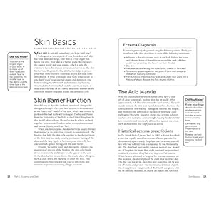 The Eczema Diet: Discover How to Stop and Prevent The Itch of Eczema Through Diet and Nutrition