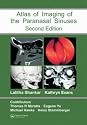 Atlas of Imaging of the Paranasal Sinuses