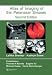 Search : Atlas of Imaging of the Paranasal Sinuses, Second Edition