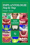 Implantologie Step by Step 2: Unterkiefer