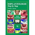 Implantologie Step by Step 2: Unterkiefer