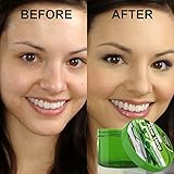 Best Natural Pure Aloe Vera Gel for Skin Face Hair & Body Moisturizer for Soothing Sunburn Windburn Insect Bites Anti Aging & After Shave Gel By Preci