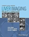 Liver imaging : MRI with CT correlation