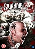 Skinning - We Are The Law [DVD]