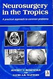 Neurosurgery in the tropics : a practical approach to common problems