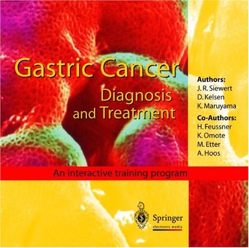 gastric cancer