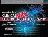 Current practice of clinical electroencephalography